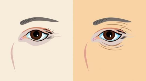 الشيخوخة المبكرة... أسبابها ووسائل درئها