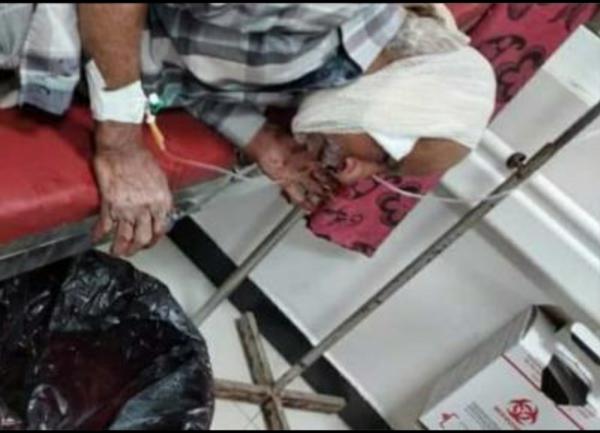  قناص حوثي يصيب رجلا مسنا في قرية العنين بتعز