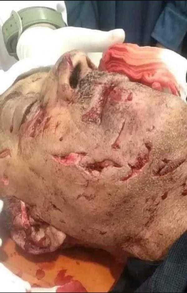 نمر يفترس عامل في حديقة الحيوان بتعز