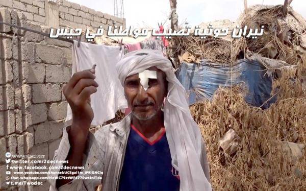 إصابة مواطن في حيس بالحديدة بنيران حوثية