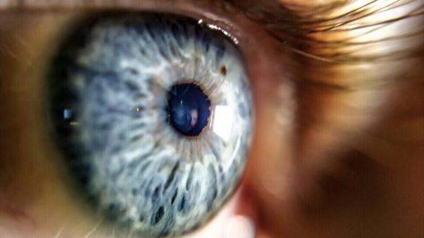 الأطعمة المضادة للالتهابات "الأفضل" لمعالجة جفاف العين ومنع فقدان البصر