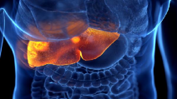 كيف يؤثر الصيام المتقطع على مرضى الكبد الدهني غير الكحولي؟