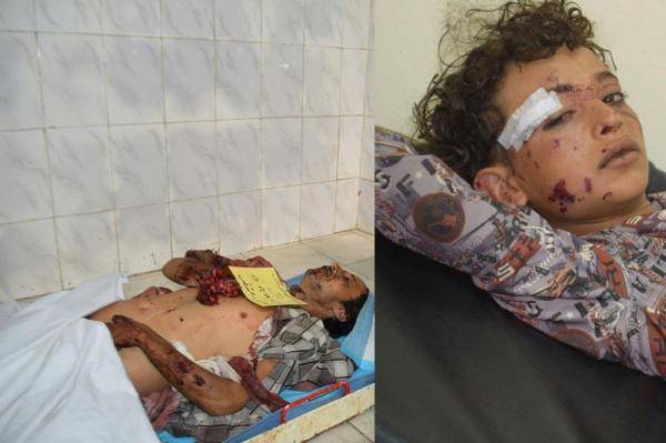 استشهاد مدني وإصابة طفل بانفجار قذيفة حوثية بتعز