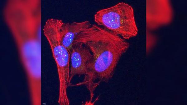 اكتشاف طبي يعبد الطريق أمام فهم أدق لمرض السرطان