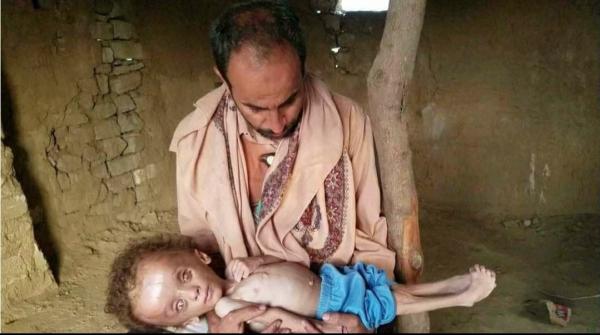 المطالبة بالافراج عن رجل الخير الغيلي من سجون الحوثي