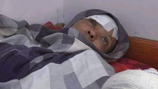 مليشيا الحوثي ترد على خسائرها في تعز بإمطار الإحياء السكنية بقذائف الهاون