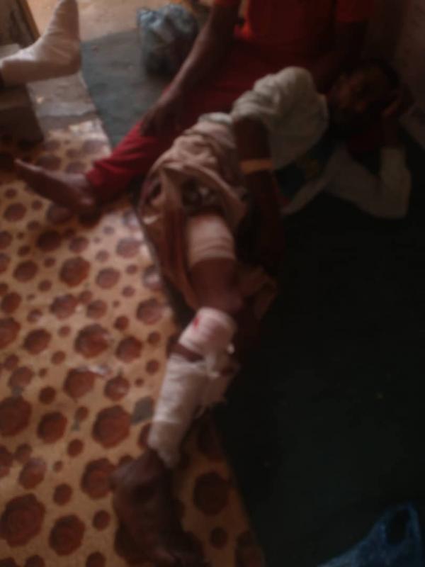 عصابة مسلحة تعتدي على المهمشين في تعز 