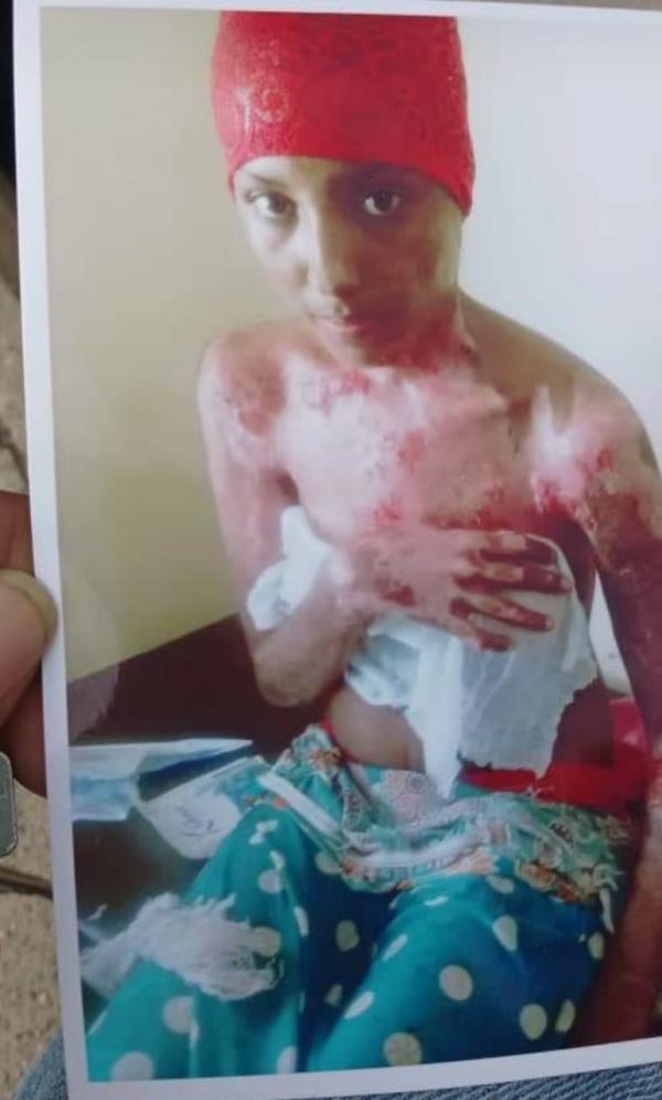 جريمة تفضح ظلم قيادات الإخوان بحق المستضعفين في تعز