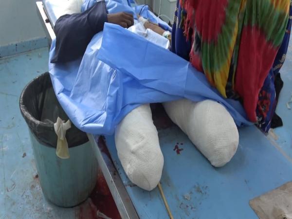 لغم حوثي محرم دوليا يحيل فرحة أسرة نازحة  إلى مأساة في حيس