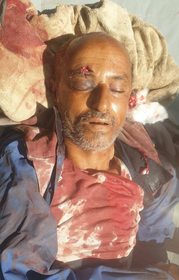 مقتل مسن برصاص قناص حوثي بريف تعز 