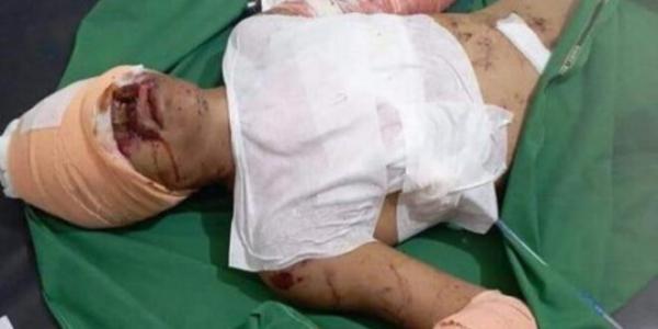 إصابة شقيق الطالبة الفائزة بجائزة  القرآن بمقذوف حوثي