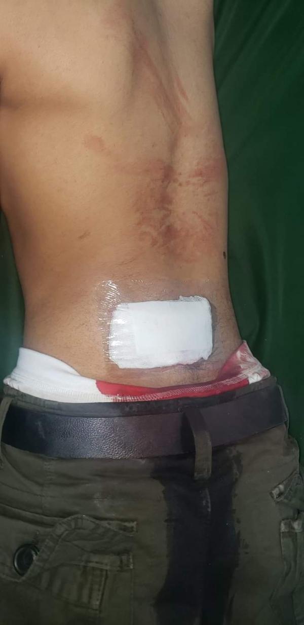 عصابة الحوثي تعتدي على ناشط حقوقي ونجله في صنعاء