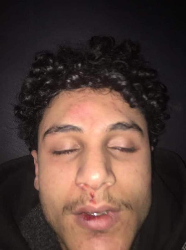 عصابة تعتدي على شاب وتهشم جمجمته في إب 