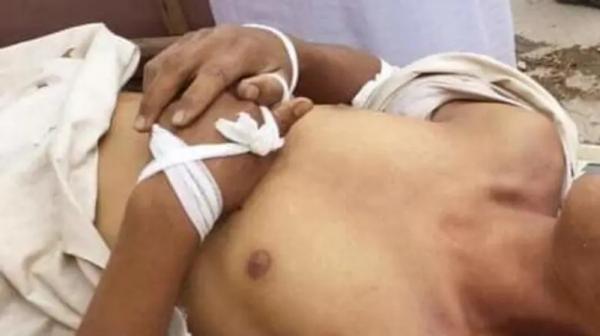 منظمة في هولندا تدين قتل عصابة الحوثي لطفل في صعدة