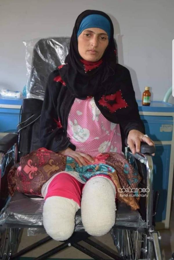 الحوثي آلة موت تحصد اليمنيين