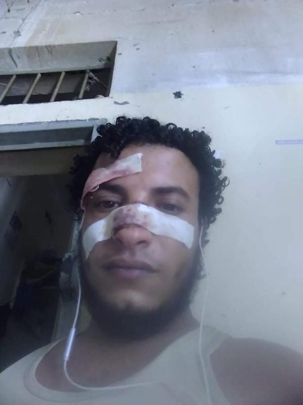 محاولة قتل داخل السجن المركزي بتعز 