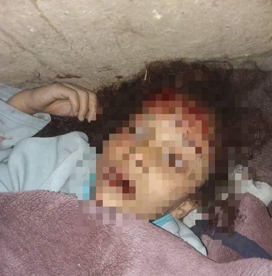 أب يقتل طفلته بدم بارد في جريمة بشعة اهتزت لها محافظة إب