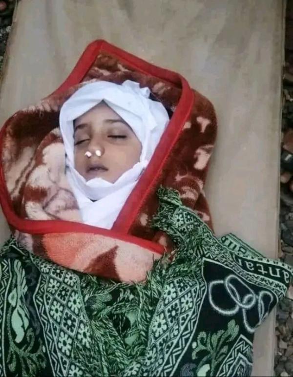 وفاة طفل في حفرة تجميع النيس في بني يوسف بتعز 