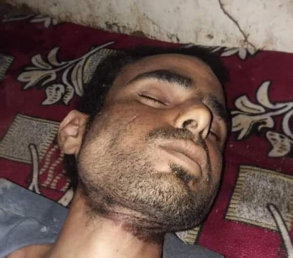 الحوثي يدفع شابا للانتحار في ريمة