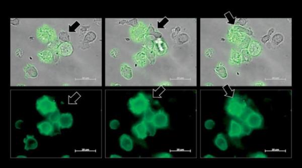 اكتشاف آلية تستخدمها خلايا سرطان الدم لـ«تنويم المناعة»