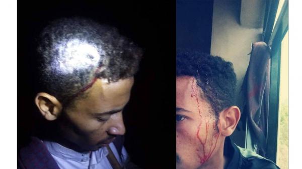 ضحايا بهجوم لميليشيا الحوثي على جامع في إب