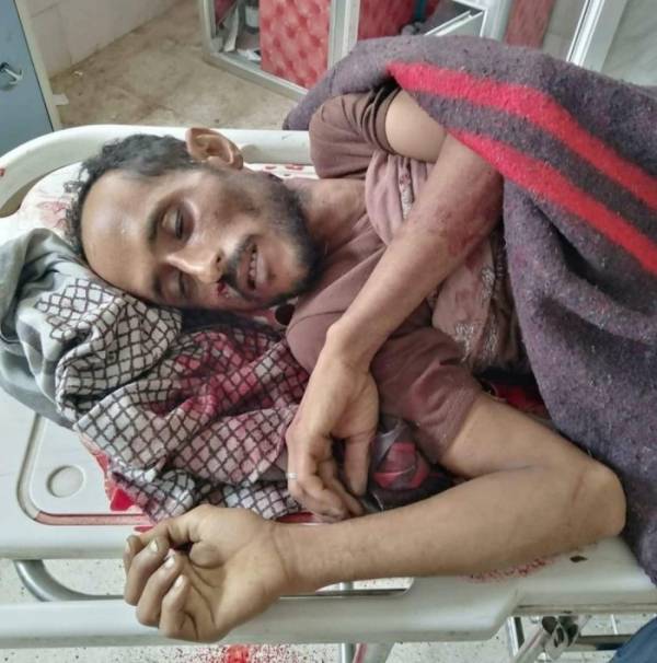 قيادي حوثي يصفي أحد أتباعه رمياً بالرصاص بمقبنة "تعز" - صورة
