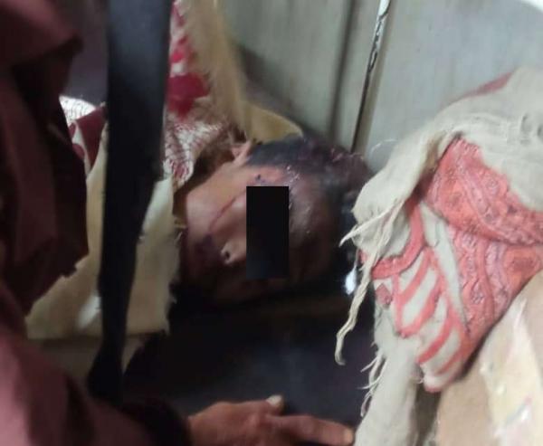 وفاة طفل جراء سقوط سيارة داخل بئر في تعز