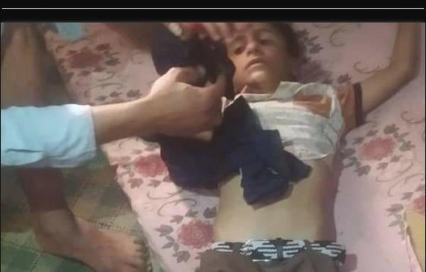 إصابة طفل من الصلو بنيران مليشيا الحوثي 