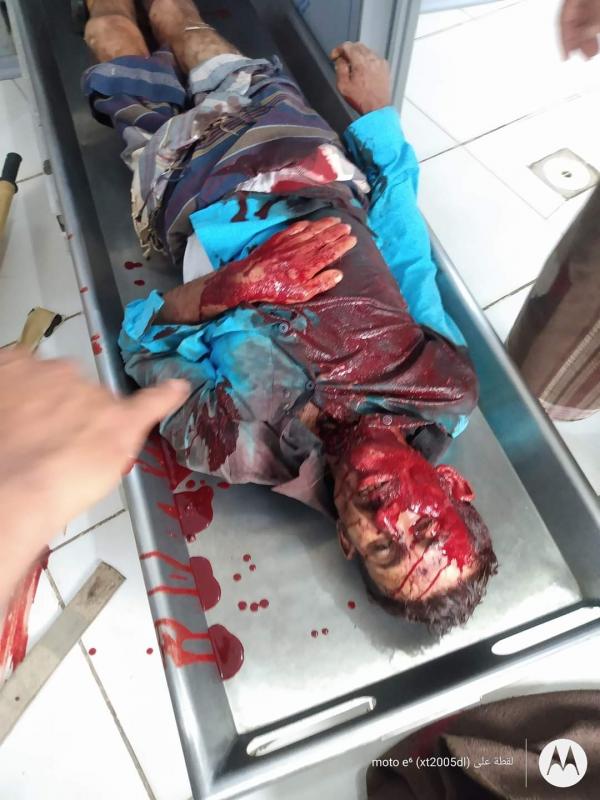 حادثة قتل بشعة لراعٍ في جبل صبر بتعز