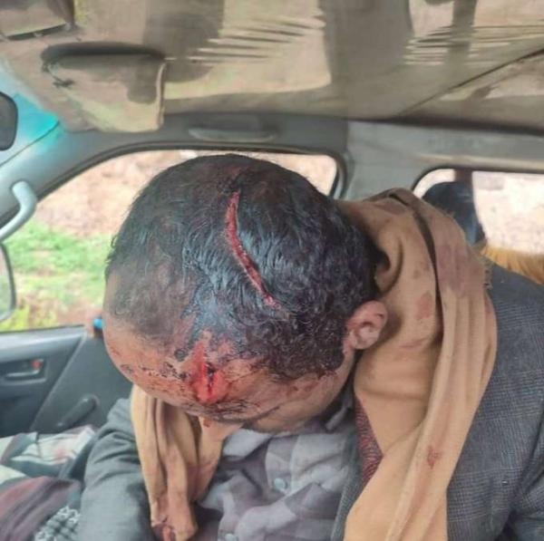 إب.. خطيب حوثي يعتدي على مريض نفسي داخل مسجد في العدين 