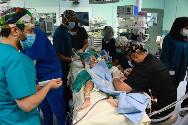 نجاح فصل التوأم السيامي اليمني "يوسف وياسين" في عملية استغرقت 15 ساعة