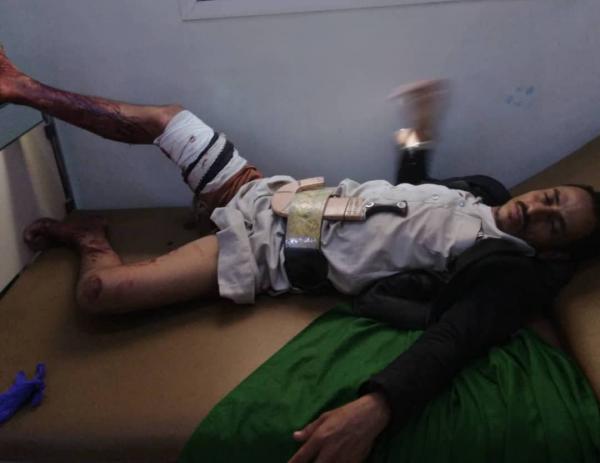 ذمار: عصابة تتبع رئيس هيئة الزكاة بإب تعتدي على أفراد من ال مسحق وتنهب أراضيهم