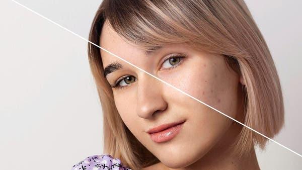 8 حلول جذريّة للقضاء على مشكلة توسّع المسام