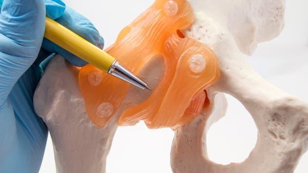 علماء يطورون طلاء لزراعة العظام.. مستوحى من أجنحة الحشرات