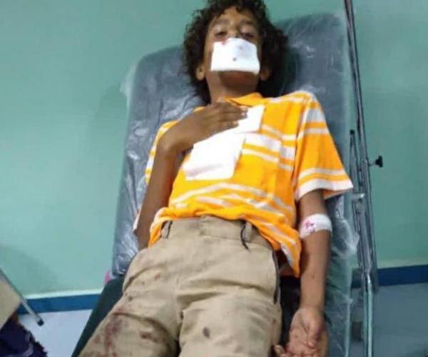 ميليشيا الحوثي تستهدف رعاة أغنام في بلدة مرخزة شمال الضالع