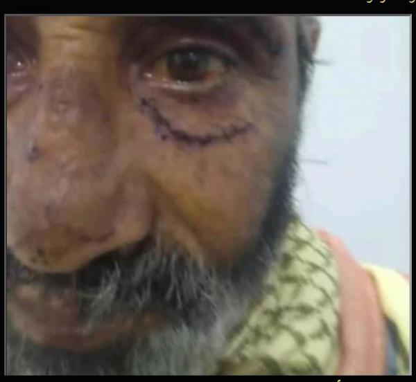 عصابة حوثية تعتدي بالضرب على مسن طالب نيابة آنس بحماية أمواله من النهب 