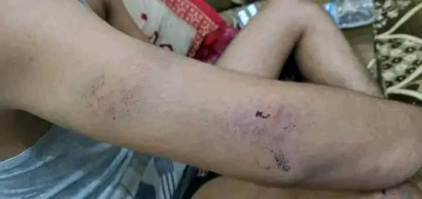 القلاع عادت لتستخدم كسجون ، وهذه المرة من تعز 