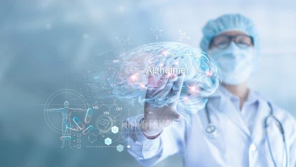 أسباب غير متوقعة للإصابة بمرض ألزهايمر.. دراسة تكشف