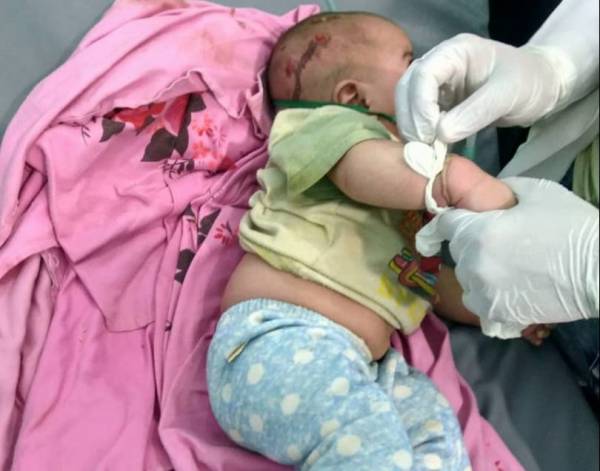 إصابة امرأة وطفلين في قصف نفذته مليشيا الحوثي على الغيل بالجوف..! – (صورة)