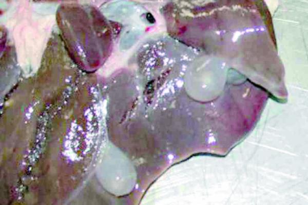 طبيبة يمنية تحذر من أكل كبد أضحية العيد بهذه "الطريقة"..!