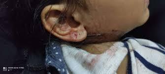 كلاب مسعورة تهاجم المواطنين في تعز 