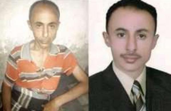   صورة مؤلمة لصحفي بعد خروجه من سجن الحوثي