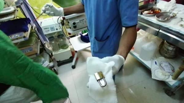 مستشفى حضرموت يشهد أغرب  حالة مرضية