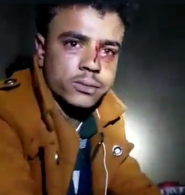   قيادي حوثي يعذب مواطناً من ريمة بطريقة وحشية  