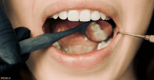علامات تظهر على الفم لا تتجاهلها.. دليل على أمراض خطيرة