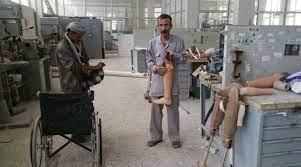 دعم كويتي لمشروع بناء مركز للأطراف الاصطناعية بتعز 