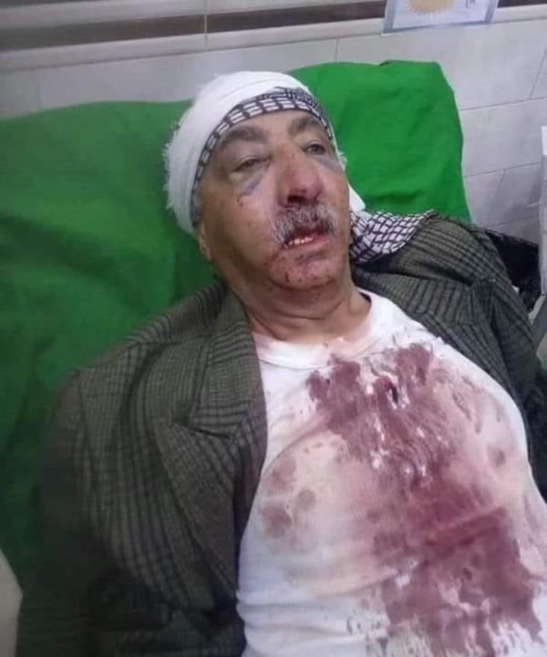 مليشيا الحوثي تقتحم منزل شيخ قبلي بعمران وتعتدي عليه