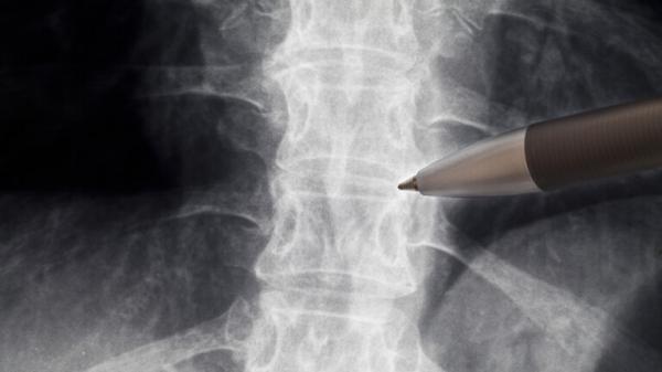 خطوة ثورية نحو علاج الشلل ..