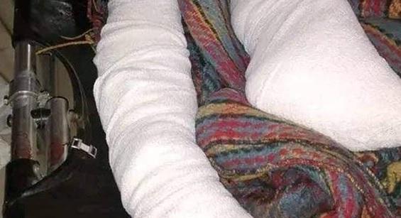 انفجار عنيف بعبوة ناسفة يستهدف معافر تعز