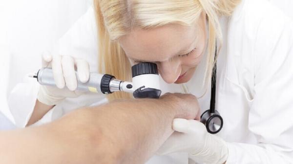 تغيرات جلدية مرتبطة بالسرطان وغيره